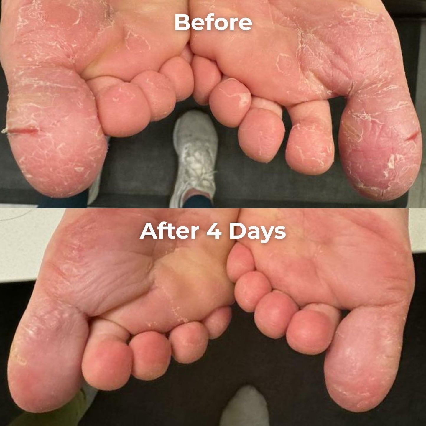 Body Balm